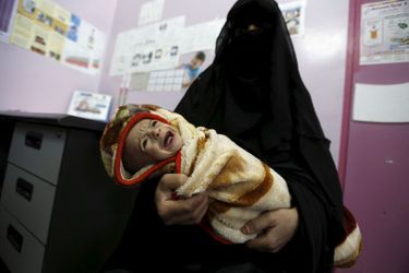 Une fillette yéménite malnutrie photographiée dans un hôpital de Sanaa, le 10 février 2016.