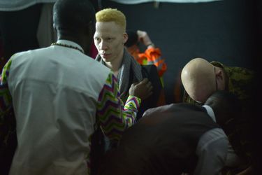 L&#039;élection de Miss et Mister Albinisme Kenya s&#039;est tenue à Nairobi vendredi soir.