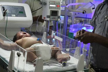 Une fillette de 6,8 kilos est née en Inde.