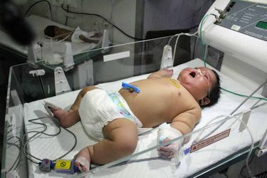 Une fillette de 6,8 kilos est née en Inde.