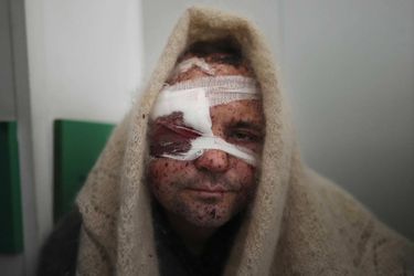 Serhiy Kralya, 41 ans, blessé dans une frappe et traité à l'hôpital de Marioupol, le 11 mars 2022.
