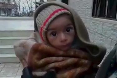 Un enfant en situation de malnutrition, présenté sur les réseaux sociaux comme ayant été photographié le 5 janvier à Madaya. 