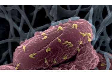 <br />
Ces phages, ici en jaune, étudiés à l’Institut Pasteur, vont venir à bout d’une bactérie. Photo grossie 50 000 fois.