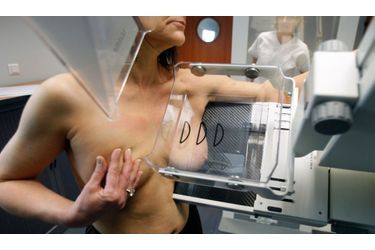 <br />
Une femme subissant une mammographie, qui permet de détecter d&#039;éventuelles tumeurs, à l&#039;hôpital Ambroise Paré à Marseille. 