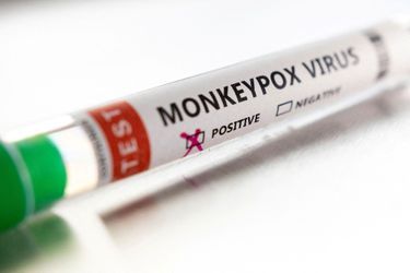 Face aux cas de variole du singe, dans un avis rendu mardi, la Haute autorité de Santé a recommandé la vaccination des adultes, y compris des professionnels de santé, ayant eu un contact à risque avec un malade. (Photo d&#039;illustration)