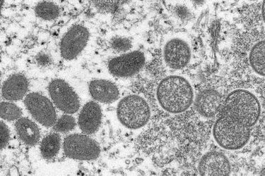 La variole du singe au microscope. 