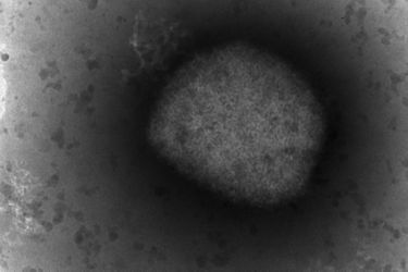 Un virus de la variole du singe.