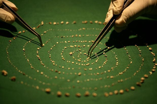 En Inde, un enfant se fait arracher 526 dents d'un coup En Inde, un enfant se fait arracher 526 dents d'un coup