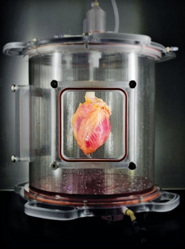 Bio Impression 3d Une Oreille Artificielle Et Vivante
