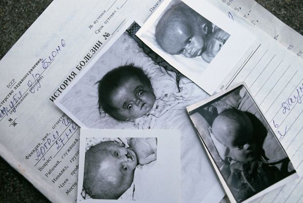 Les Enfants Maudits De Tchernobyl