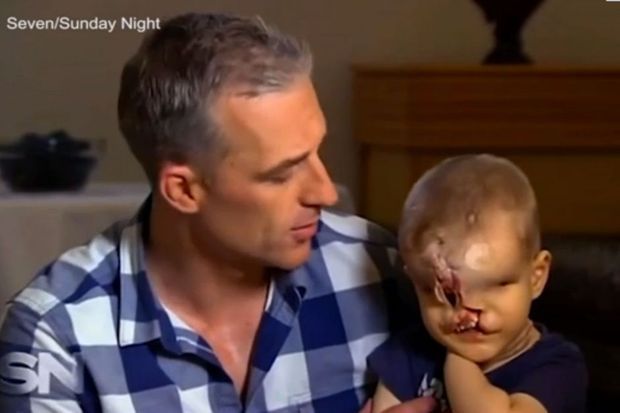 Une Nouvelle Vie S Offre A Lui Yahya Le Petit Garcon Sans Visage A Ete Opere