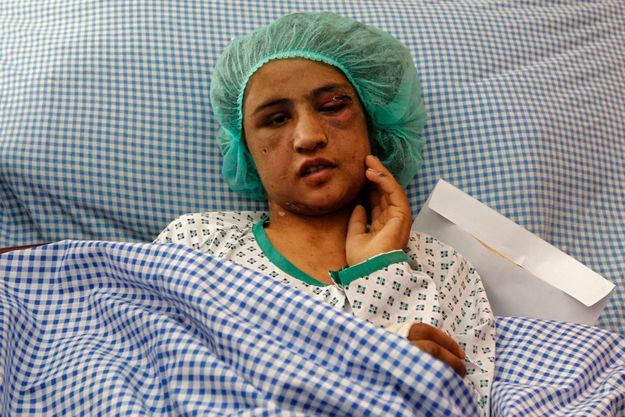 Sahar Gul à l'hôpital en décembre 2011.