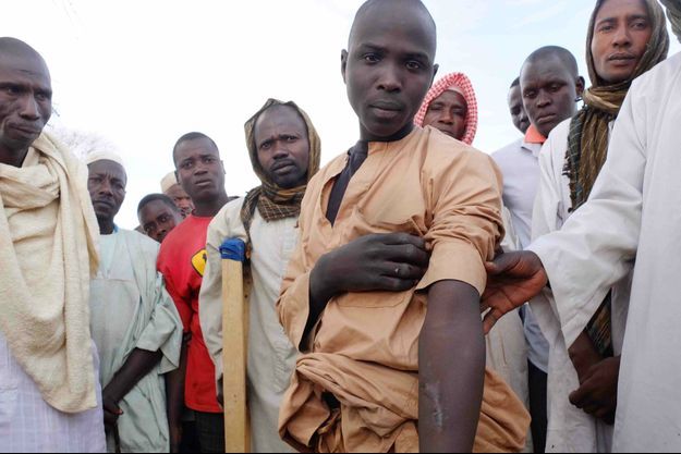 Dans un camp de réfugié à la sortie de Diffa au Niger, Malanderi nous montre sa cicatrice au bras perforé par une balle, le 13 février 2016