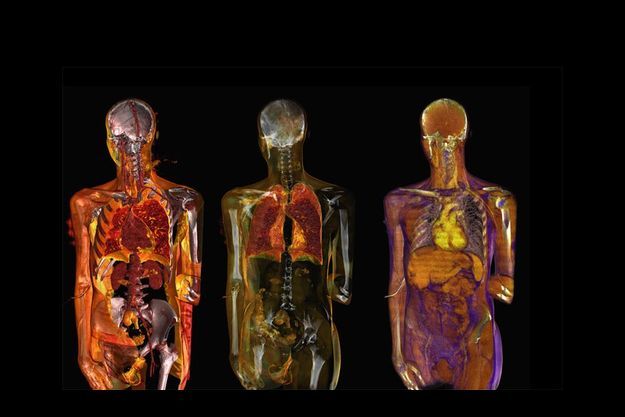 2000 2010 l 226 ge de l homme transparent 2000 2010 l 226 ge de l homme transparent