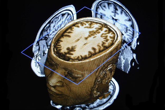 Les neurones du temps sont situés dans l'hippocampe, sous la surface du cortex cérebral.