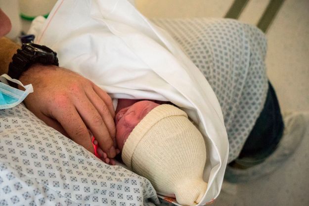 Bebes Au Bras Malforme Des Investigations Complementaires Dans Le Morbihan