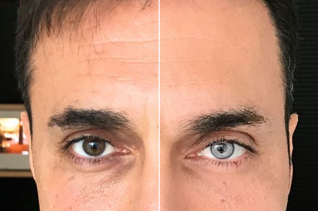 docteur changez la couleur de mes yeux