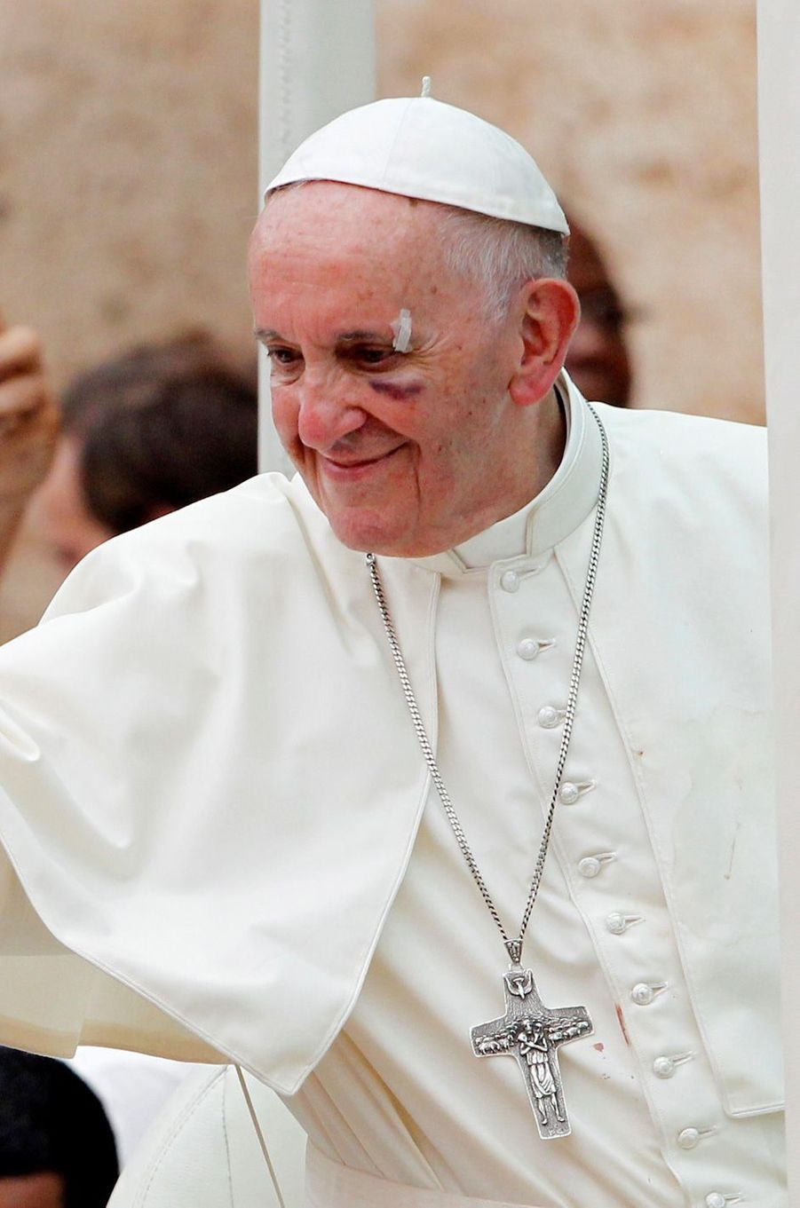 Le pape François blessé au visage... à cause de sa papamobile