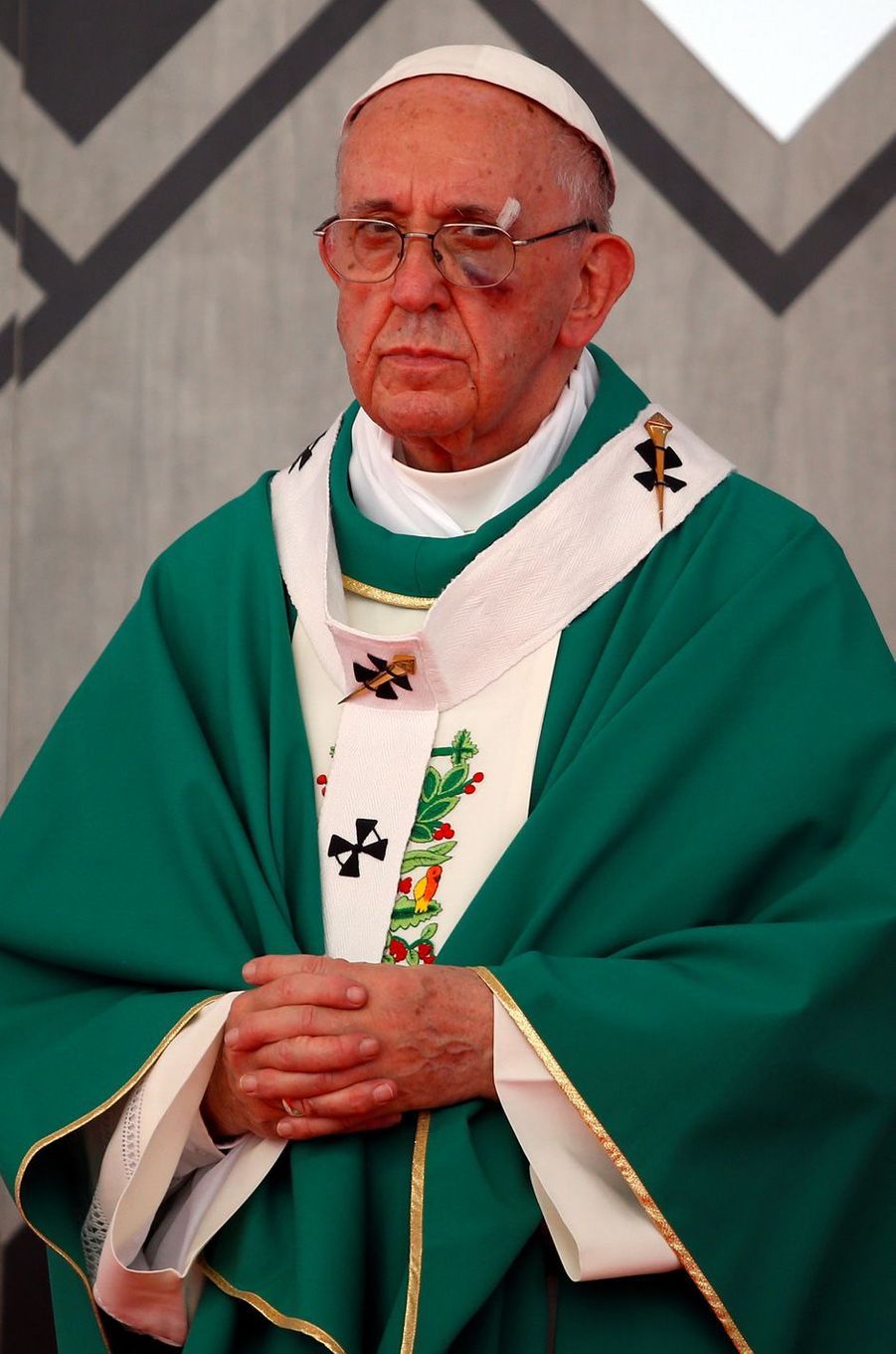 Le pape François blessé au visage... à cause de sa papamobile