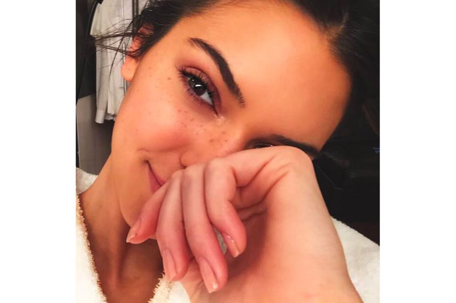 Stars sans maquillage Kendall Jenner avant / après