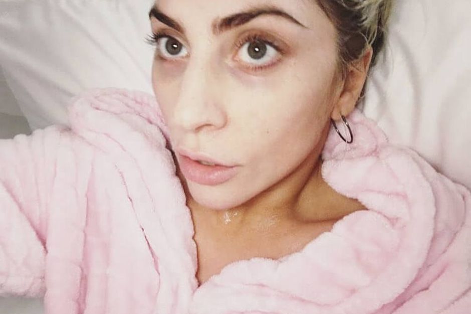 Stars sans maquillage : Lady Gaga avant / après