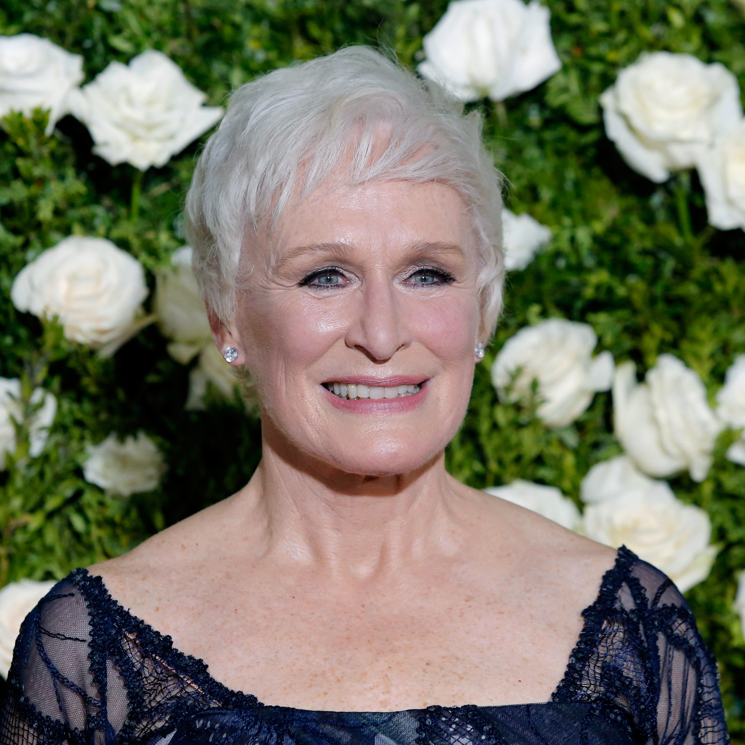 Glenn Close's Shocking Injury: Broken Nose And A Bruised Face!